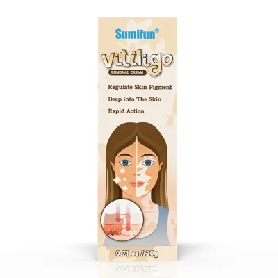 Витилиго (Vitiligo cream Sumifun) крем, 20 г